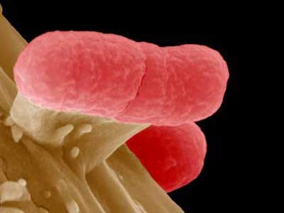 Salatalktan bulaan EHEC Bakterisi